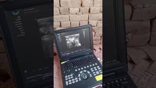 User Dr Qaim Virk GRW doing Veterinary ultrasound with E30 Color Doppler in black and white price.