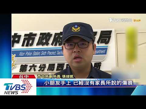 「痛痛」　5歲女童遭幼園師拿別針刺手15洞