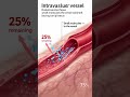 🚨Masters class of Icu series-- Intravenous fluids 💉🩺🏥#drarchanasinha  @Life_in_ICU_yt 👈follow ✨️