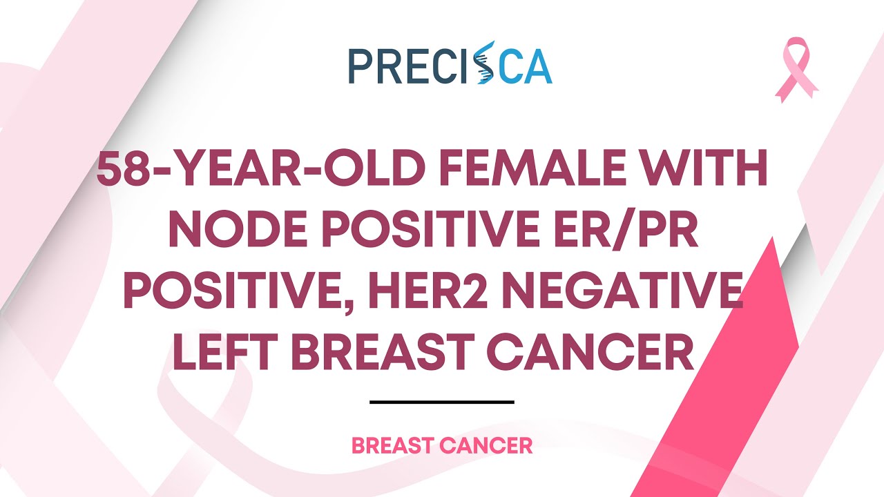 Expert Cancer Panel: Node positive ER/PR positive, HER2 negative left ...