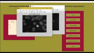 Radon transform for watershed segmentation matlab projects