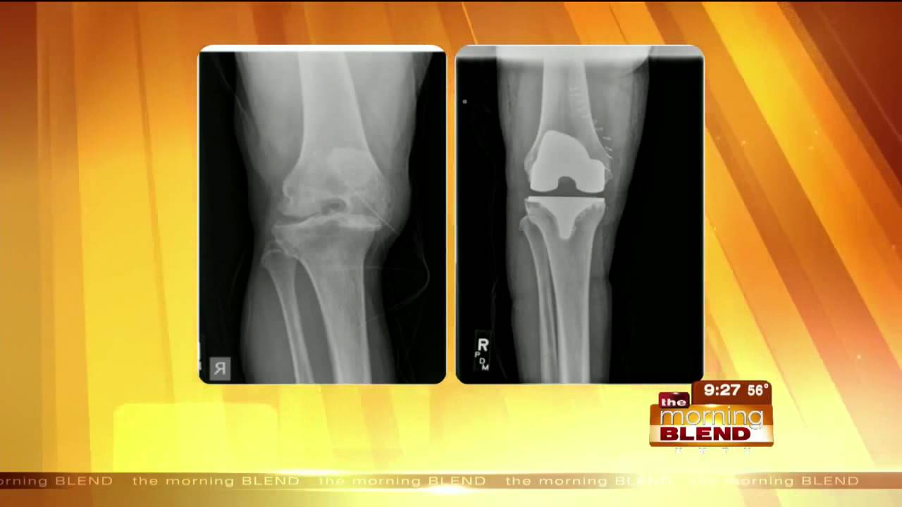 Dr. Boese on KMTV’s Morning Blend on Friday, Sept. 11th