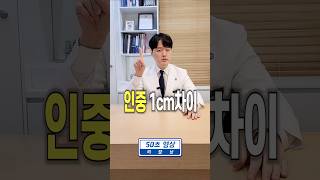 인중길이를 줄이는 '수술' 말고 '시술'은?? 50초 설명!