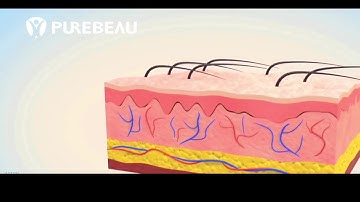 How Fibroblast Works