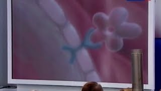 Сахарный диабет: типы, симптомы и лечение Сахарный диабет: типы, симптомы и лечение