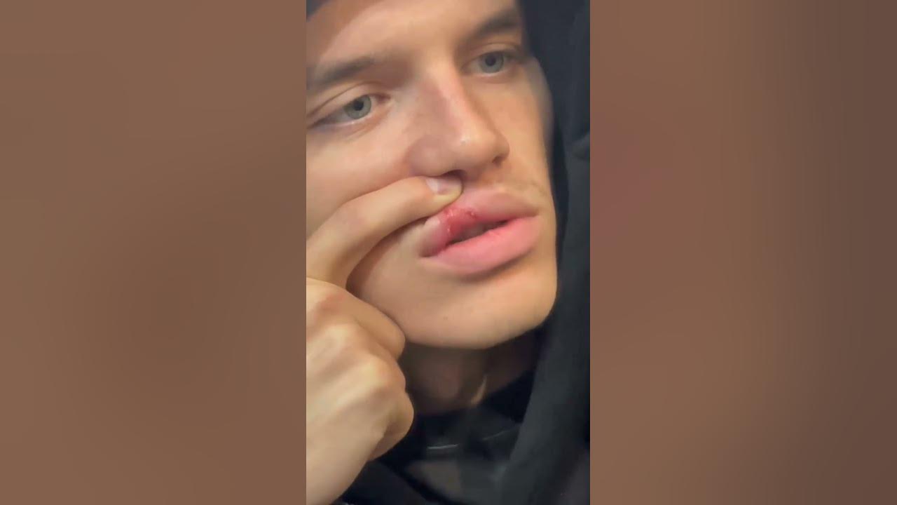 Бой литвина и бойца. Бой литвина и бойца. Промоушен бои картинка. Видео литвина. Бой литвина и бойца.