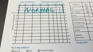 How to Read Your Audiogram