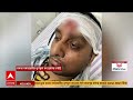 LIVE | SFI vs ABVP : উত্তপ্ত বারুইপুর আদালত চত্বর, সায়নকে লক্ষ্য করে ডিম | #abpananda