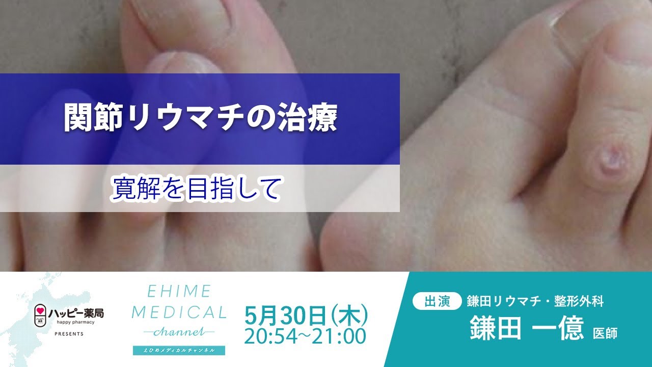 ❤️❤️❤️❤️関節リウマチ（第2版）❤️❤️寛解を目指す治療の新時代 リウマチ～治療篇～」EHIME MEDICAL channel 5月30日予告 - YouTube