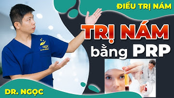 Huyết Tương Giàu Tiểu Cầu (PRP) Trong Trị Nám
