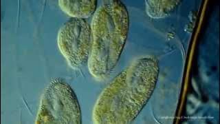 Various Ciliated Protozoa. Kingdom Protista. DIC Lighting Technique.