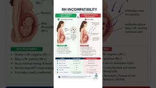 🩸🤰 RH INCOMPATIBILITY EXPLAINED 🤱🔬