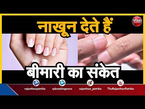 वीडियो: नाखून की बीमारी क्या है?