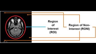 Tutorial 6- Region of Interest(ROI) | Image Processing Course | Computer Vision screenshot 3