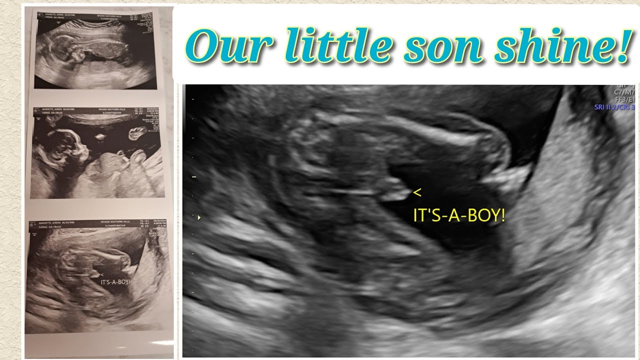 Early birthday gift sent from above, our little son shine!❤️