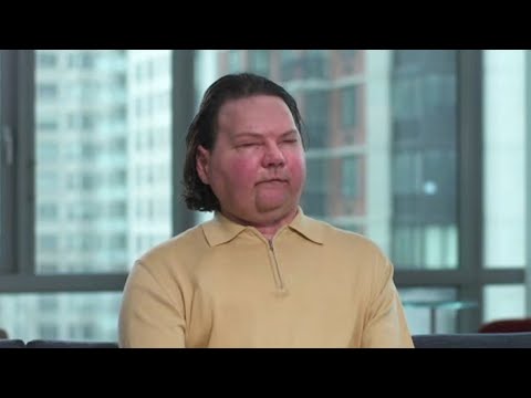 Операция Джо ДиМео продлилась 23 часа и завершилась успехом
