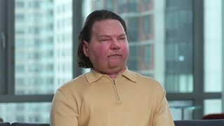 22-year-old man has first successful face, double hand transplant | ABC7 screenshot 5