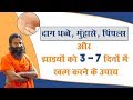 दाग धब्बे, मुंहासे, पिंपल्स और झाइयों को 3 - 7 दिनों में खत्म करने के उपाय | Swami Ramdev