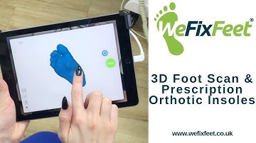 3D Foot Scanning and Manufacture of Bespoke Prescription Orthotic Insoles