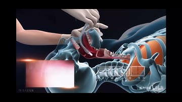 Video Stylet intubation training demo