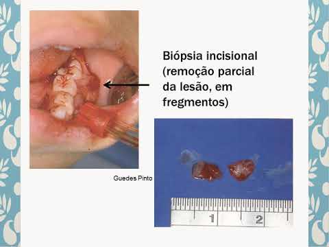 Semiologia aplicada a Odontopediatria parte 1