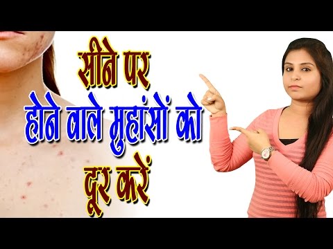 सीने पर होने वाले मुँहासों को दूर करें Body Acne Treatment | Pimples Problem At Back - Health Tips