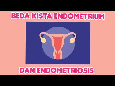 Beda kista endometrium dan endometriosis