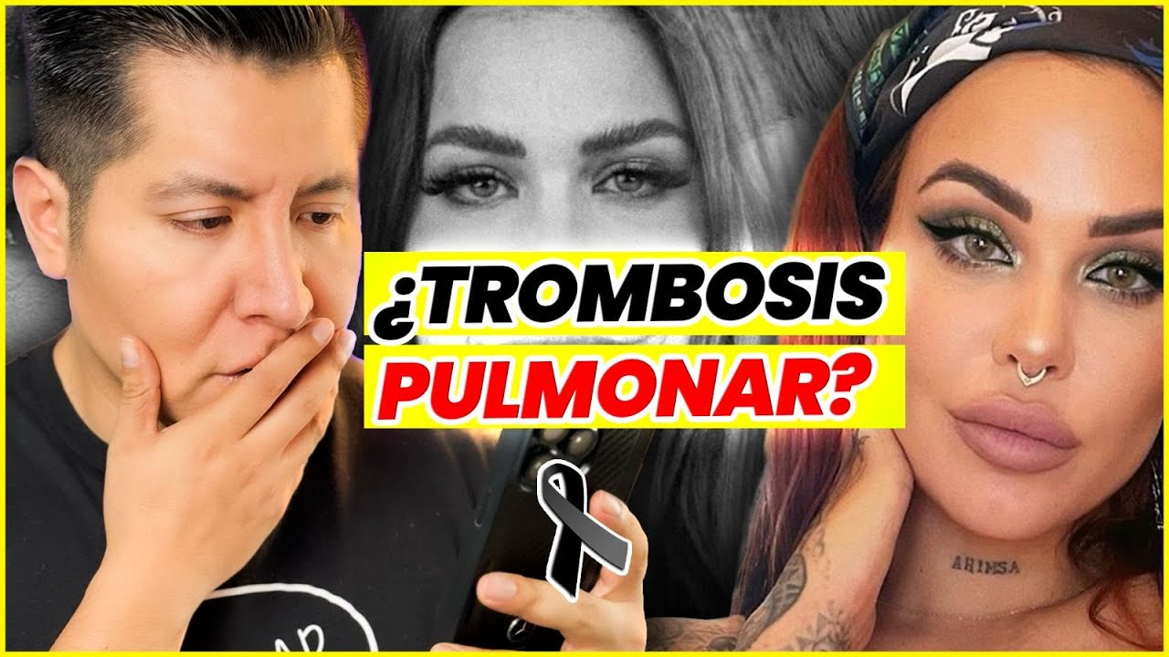 Influencer ELENA LARREA MUERE. ¡Su AMIGA REVELA la VERDAD! | Mr Doctor
