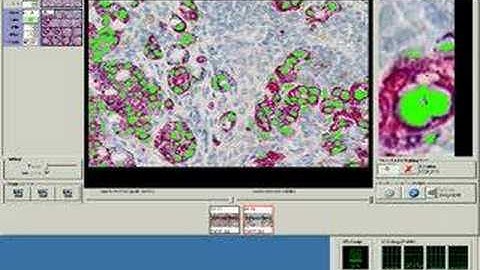 GemIdent demo - Finding cancer cells (part 2 / 2)