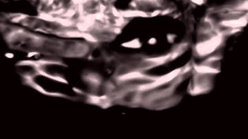 ZIGO-Ginnetta Correli---gun+Elk