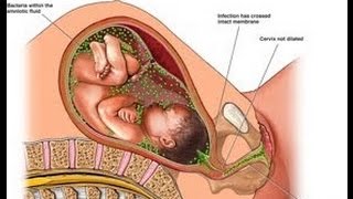 Infections You Should Be Aware Of During Pregnancy