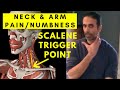 NECK & ARM pain Relief: Scalene Muscle Trigger Points
