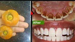 تبييض الاسنان بالمنزل في 3 دقائق || كيف تبيض أسنانك الصفراء بشكل طبيعي || فعالية 100٪