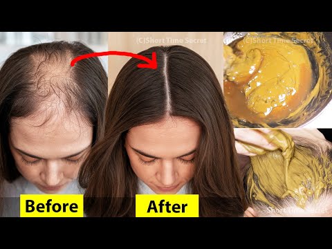 In 30 Days - Grow Hair Like Crazy - Use HENNA for Extreme Long Thick Hair