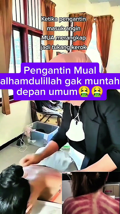 pengantin mual muntah masuk angin di hari resepsi #kerokan #pijatpengobatan #demam #massage #mual