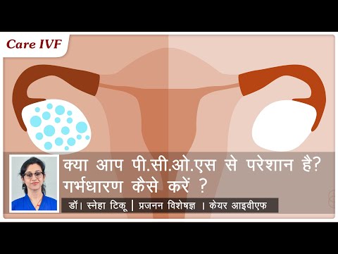 पी.सी.ओ.एस की समस्या का समाधान क्या है ? पी.सी.ओ.एस-ग्रस्त महिलाए माँ कैसे बन सकती हैं?