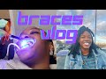 Ok, I got Braces | BRACEFACE ep. 1