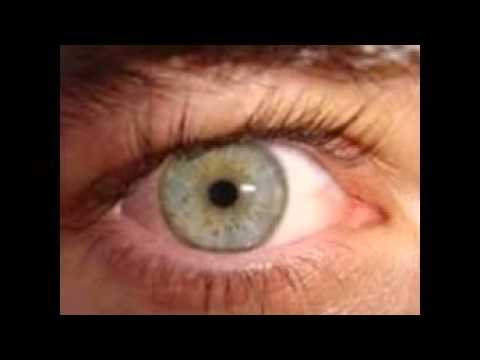 Eye Diseases With Pictures - YouTube