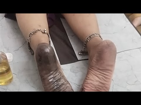 Detox Foot Massage Therapy|#painreliefofficial #detox#detoxmassage #trending #detoxdrink#live#shorts