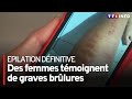 Epilation dfinitive  des femmes tmoignent de graves brlures