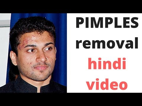 How To Clear Pimples On Face Naturally In Hindi How To Clear Pimples On Face Naturally In Hindi