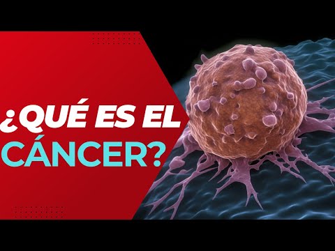 Vídeo: El carcinoma ductal in situ pot tornar?