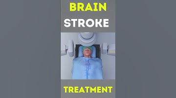 Brain stroke treatment 3d animation