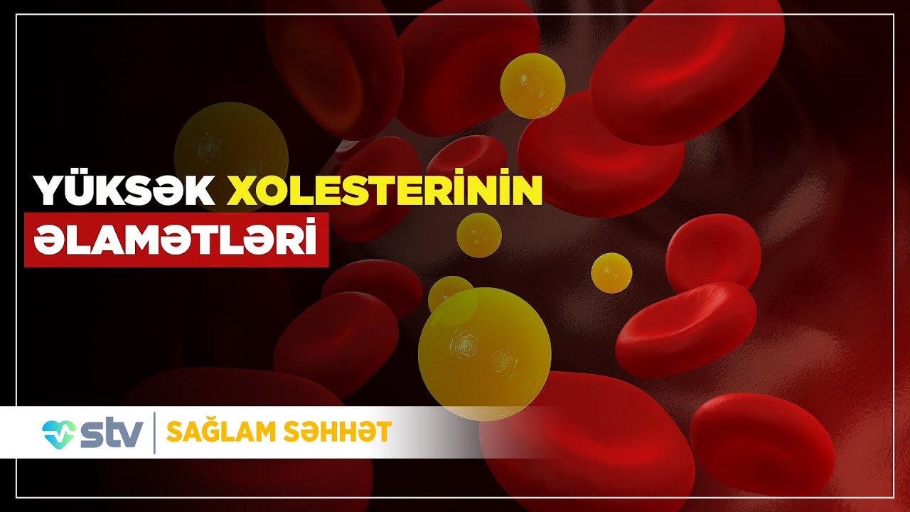 Xolesterinin yüksək olduğunu necə bilək? - (06.10.2025)