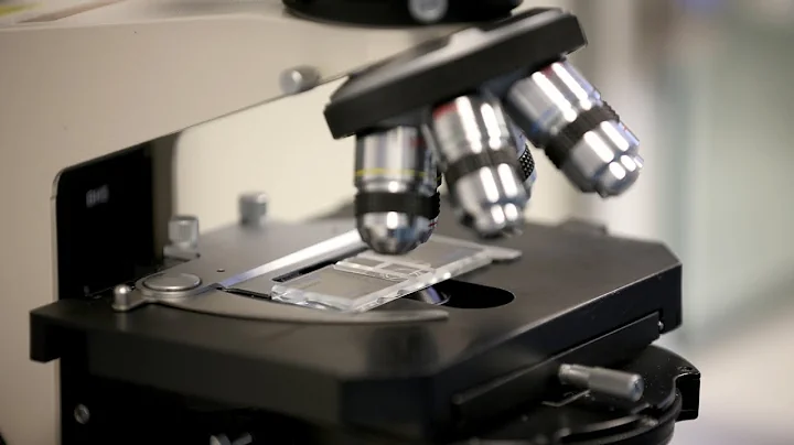 Why antibiotic resistance has become a problem