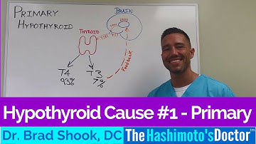 Hypothyroid Cause Primary Hypothyroidism Pattern 1