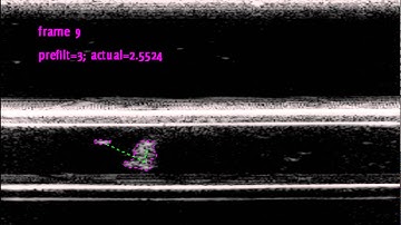 Tracking emboli with ultrafast ultrasound imaging
