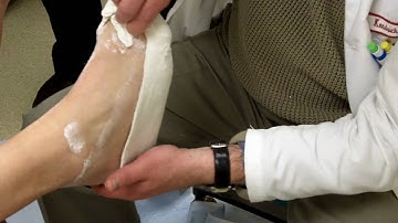 Part 2: Casting for Orthotics with Dr. Whitney (cast removal)