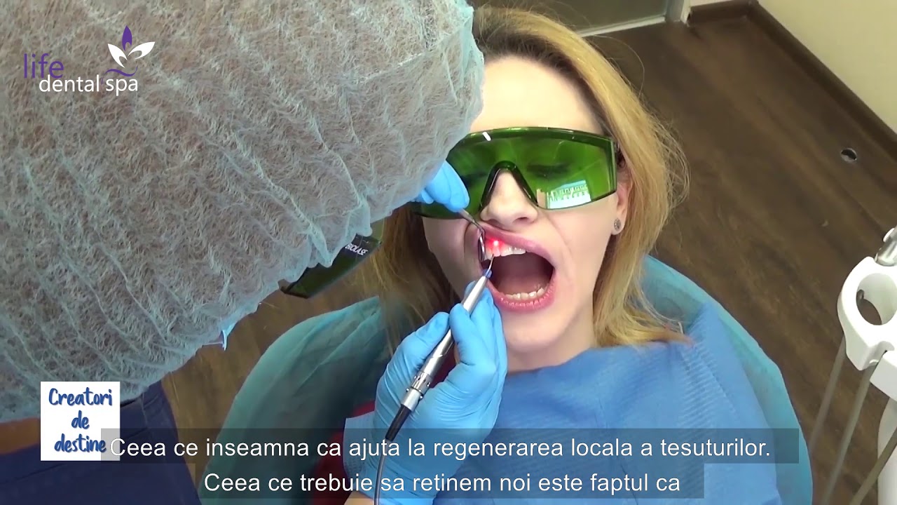 Tratament pentru parodontoza - Fara Durere 😲
