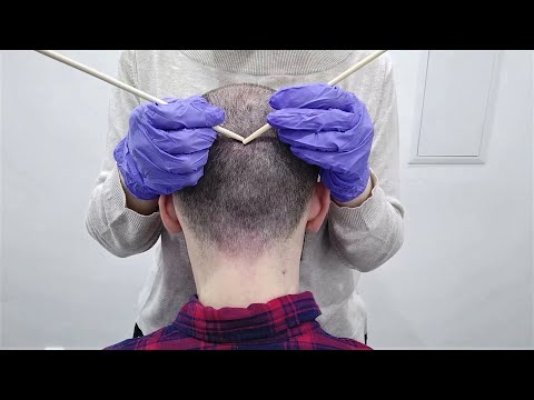 ASMR 💯 Massive Tingles 💯 Strange Head Exam With Gloves And Tools